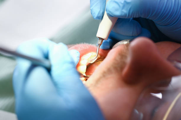Best Orthodontic Emergency Dentist in Western Lake, TX
