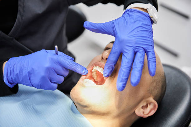 Best Emergency Dentist for Knocked-Out Tooth in Western Lake, TX